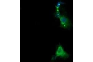 RARRES1 antibody