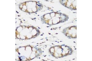Immunohistochemistry of paraffin-embedded human colon using BMP2 antibody (ABIN5970060) at dilution of 1/200 (40x lens). (BMP2 antibody)