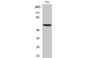 Western Blotting (WB) image for anti-Nuclear Factor-kB p65 (NFkBP65) (Thr693) antibody (ABIN3176322) (NF-kB p65 antibody  (Thr693))