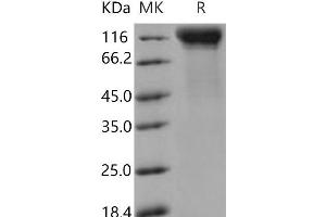 IL12RB2 Protein (His tag)