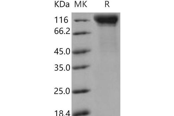 IL12RB2 Protein (His tag)
