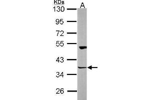 WB Image Sample (30 ug of whole cell lysate) A: NT2D1 10% SDS PAGE antibody diluted at 1:1000 (HOMER3 antibody  (Center))