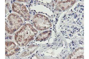 Immunohistochemical staining of paraffin-embedded Human Kidney tissue using anti-HOXC11 mouse monoclonal antibody. (HOXC11 antibody  (AA 1-304))