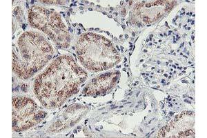 Immunohistochemical staining of paraffin-embedded Human Kidney tissue using anti-HOXC11 mouse monoclonal antibody.