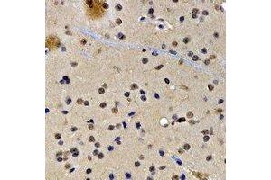 Immunohistochemical analysis of SATB1 staining in rat brain formalin fixed paraffin embedded tissue section. (SATB1 antibody)