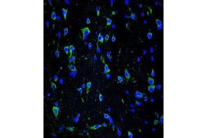 Immunofluorescence (IF) image for anti-Internexin Neuronal Intermediate Filament Protein, alpha (INA) antibody (ABIN2995365)