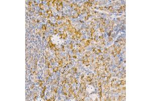 Immunohistochemistry of paraffin-embedded rat spleen using [KO Validated] RA Rabbit pAb (ABIN3021646, ABIN3021647, ABIN3021648 and ABIN1513457) at dilution of 1:100 (40x lens). (RAB5 antibody  (AA 1-215))