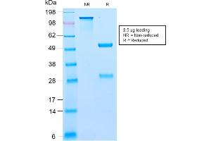 SDS-PAGE Analysis Purified BCL10 Recombinant Rabbit Monoclonal Antibody (BL10/2988R). (Recombinant BCL10 antibody  (AA 122-168))