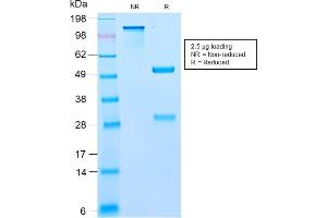SDS-PAGE Analysis Purified BCL10 Recombinant Rabbit Monoclonal Antibody (BL10/2988R).