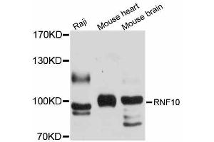 Western blot analysis of extracts of various cell lines, using RNF10 antibody (ABIN5998702) at 1/1000 dilution. (RNF10 antibody)