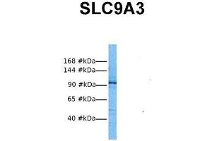 Host:  Rabbit  Target Name:  SLC9A3  Sample Tissue:  Human RPMI-8226  Antibody Dilution:  1. (SLC9A3 antibody  (Middle Region))