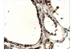 ABIN263200 (4µg/ml) staining of paraffin embedded Human Thyroid Gland. (DUOX1 antibody  (Internal Region))