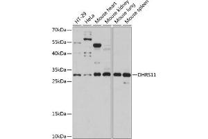Western blot analysis of extracts of various cell lines, using DHRS11 antibody (ABIN7266723) at 1:1000 dilution. (DHRS11 antibody  (AA 1-260))