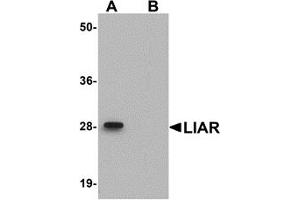 Western Blotting (WB) image for anti-Ankyrin Repeat Domain 54 (ANKRD54) (C-Term) antibody (ABIN1030482) (ANKRD54 antibody  (C-Term))