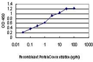 Detection limit for recombinant GST tagged DYRK2 is approximately 0. (DYRK2 antibody  (AA 1-100))