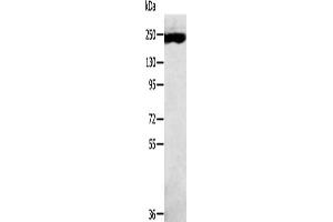 Gel: 6 % SDS-PAGE, Lysate: 40 μg, Lane: K562 cells, Primary antibody: ABIN7191442(MED13 Antibody) at dilution 1/300, Secondary antibody: Goat anti rabbit IgG at 1/8000 dilution, Exposure time: 10 minutes (MED13 antibody)