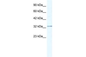 Western Blotting (WB) image for anti-Nudix (Nucleoside Diphosphate Linked Moiety X)-Type Motif 9 (NUDT9) antibody (ABIN2461167) (NUDT9 antibody)