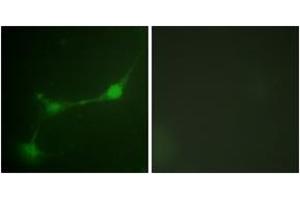 Immunofluorescence (IF) image for anti-Ataxin 1 (ATXN1) (AA 742-791), (pSer776) antibody (ABIN1531488)