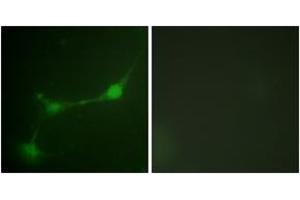 Immunofluorescence analysis of NIH-3T3 cells, using Ataxin 1 (Phospho-Ser776) Antibody.