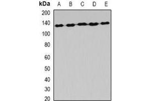 Western blot analysis of AlaRS expression in Hela (A), MCF7 (B), mouse liver (C), mouse brain (D), rat spinal cord (E) whole cell lysates. (AARS2 antibody)
