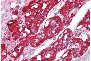 Human Adrenal (formalin-fixed, paraffin-embedded) stained with CHGA antibody ABIN214090 at 5 ug/ml followed by biotinylated goat anti-rabbit IgG secondary antibody ABIN481713, alkaline phosphatase-streptavidin and chromogen. (Chromogranin A antibody  (C-Term))