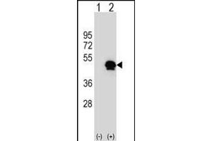 Western blot analysis of SERPINE1 (arrow) using rabbit polyclonal SERPINE1 Antibody (Center) (ABIN656843 and ABIN2846050). (PAI1 antibody  (AA 188-216))