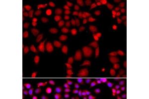 Immunofluorescence analysis of A549 cells using ARHGEF9 Polyclonal Antibody (Arhgef9 antibody)