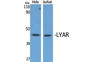 Western Blotting (WB) image for anti-Ly1 Antibody Reactive (LYAR) (Internal Region) antibody (ABIN3185425) (LYAR antibody  (Internal Region))