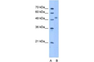 Western Blotting (WB) image for anti-Zinc Finger Protein 763 (ZNF763) antibody (ABIN2463332) (ZNF763 antibody)