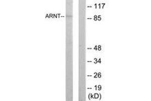 Western blot analysis of extracts from HepG2 cells, using ARNT Antibody.