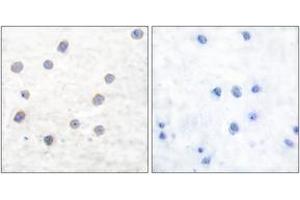 Immunohistochemistry (IHC) image for anti-Tyrosine Hydroxylase (TH) (AA 41-90), (pSer71) antibody (ABIN1531207)