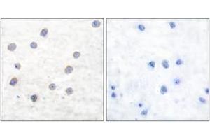Immunohistochemistry analysis of paraffin-embedded human brain, using Tyrosine Hydroxylase (Phospho-Ser40) Antibody. (Tyrosine Hydroxylase antibody  (pSer71))