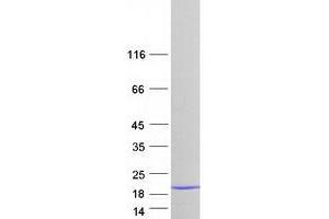 Validation with Western Blot (LSM3 Protein (Myc-DYKDDDDK Tag))