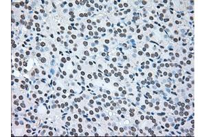 Image no. 1 for anti-B-Raf proto-oncogene, serine/threonine kinase (BRAF) antibody (ABIN1496961) (BRAF antibody)