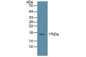 Detection of LEP in Mouse Lymph Node Tissue using Polyclonal Antibody to Leptin (LEP) (Leptin antibody  (AA 22-167))