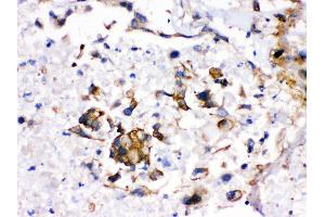 Anti- CYP1A2 Picoband antibody, IHC(P) IHC(P): Human Liver Cancer Tissue (CYP1A2 antibody  (AA 185-320))