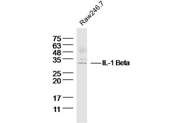 IL-1 beta Antikörper  (AA 101-200)