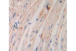 Used in DAB staining on fromalin fixed paraffin- embedded Kidney tissue (ADCY9 antibody  (AA 852-1065))