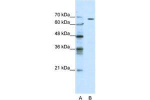 Western Blotting (WB) image for anti-gamma-aminobutyric Acid (GABA) Receptor, theta (GABRQ) antibody (ABIN2461123)
