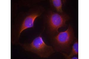 Immunofluorescence staining of methanol-fixed HeLa cells using CDK6 (phospho-Tyr13) Antibody (E011542, Red) (CDK6 antibody  (pTyr13))