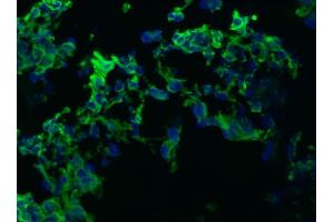 Image no. 1 for anti-Keratin 10/13 antibody (ABIN335338) (Keratin 10/13 antibody)