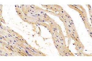 Detection of TGFb1 in Rat Cardiac Muscle Tissue using Polyclonal Antibody to Transforming Growth Factor Beta 1 (TGFb1) (TGFB1 antibody  (AA 279-390))