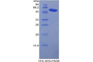 SDS-PAGE analysis of Mouse Carboxypeptidase N1 Protein.
