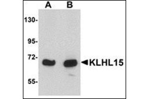 Western blot analysis of KLHL15 in HeLa cell lysate with this product at (A) 1 and (B) 2 μg/ml.