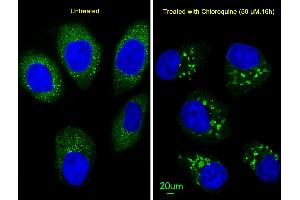 Immunofluorescent analysis of  cells, using LC3 Antibody (G8B) (N-term) 1802a. (MAP1LC3A antibody  (N-Term))
