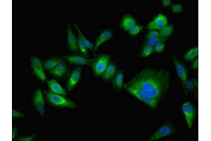 Immunofluorescent analysis of Hela cells using ABIN7146715 at dilution of 1:100 and Alexa Fluor 488-congugated AffiniPure Goat Anti-Rabbit IgG(H+L) (CA2 antibody  (AA 2-260))