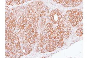 IHC-P Image Immunohistochemical analysis of paraffin-embedded SW480 xenograft, using ret finger protein, antibody at 1:100 dilution. (TRIM27 antibody)