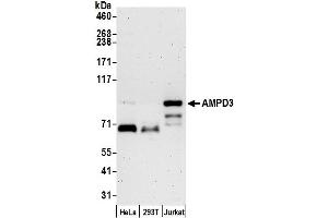 Western Blotting (WB) image for anti-Adenosine Monophosphate Deaminase 3 (AMPD3) (AA 717-767) antibody (ABIN7449959)