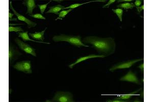 Immunofluorescence of purified MaxPab antibody to BOLL on HeLa cell. (BOLL antibody  (AA 1-295))