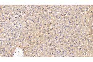 anti-Cyclin-Dependent Kinase Inhibitor 2B (p15, Inhibits CDK4) (CDKN2B) (AA 1-130) antibody
